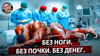 10 Культуристов Которые Доигрались