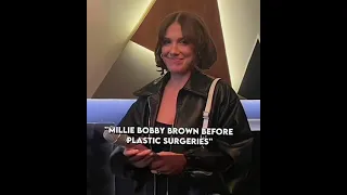 Millie Bobby Brown Before and After Cosmetic Surgery #shorts #milliebobbybrown #shortsviral