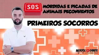 Primeiros Socorros: Mordidas e Picadas de Animais Peçonhentos