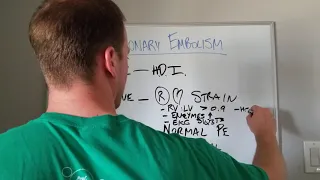 Pulmonary Embolism (PE)- Subtypes and Management