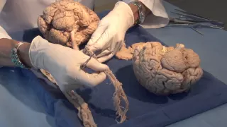 Three Critical Vertical Pathways: Neuroanatomy Video Lab - Brain Dissections