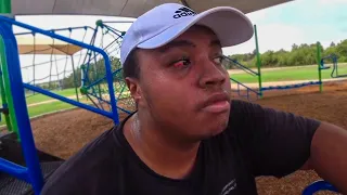 Russel's Eye turned RED after the Workout...