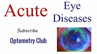 Acute Eye Diseases