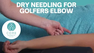 Dry Needling for Golfers Elbow - Medial Epicondylitis