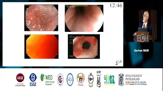 Refractory Reflux; Pharmacological therapy: PPI & beyond - Prof. Serhat BOR ( Egypt Gasro-Hep 2019)