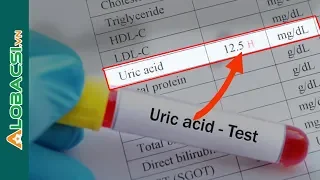 Chỉ Số Acid Uric trong máu cao CÓ Phải đã Bị GOUT?