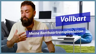 Barthaartransplantation in der Türkei | 7 Monate Post Op Update