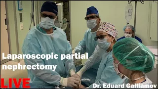 Laparoscopic partial nephrectomy LIVE / Лапароскопическая резекция правой почки
