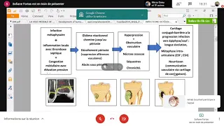 Infections Ostéo-articulaires