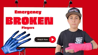 Broken Fingers Emergency || Crazy Cast