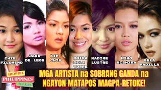 Ito Pala Sila BAGO NAGPARETOKE! Mga ARTISTA na SOBRANG GANDA na NGAYON MATAPOS MAGPA-RETOKE!