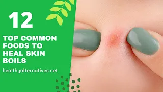 Top 12 Common Foods To Heal Skin Boils