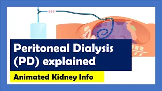 Peritoneal Dialysis... explained