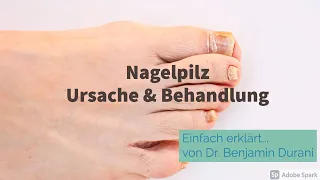 Nagelpilz Ursache & Behandlung - Einfach erklärt mit Dr. Durani (Facharzt für Hautkrankheiten)
