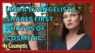 LINDA EVANGELISTA SHARES FIRST PHOTOS OF COSMETIC PROCEDURE SHE SAYS DISFIGURED HER