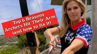 Archery: Why Archers Hit Their Arm and How To Fix It