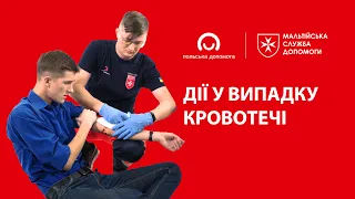 Перша допомога при кровотечах