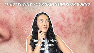 Signs of Damaged Skin Barrier You're Probably Ignoring