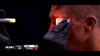 😱Rico suffers HUGE cut under the eye during glory collision 3 #shorts #glory