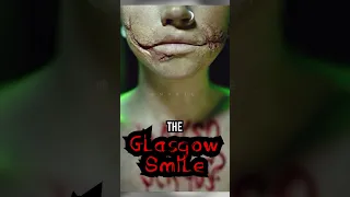 The Glasgow Smile - The Black Dahlia: A True Story #shorts #@nightmares_1