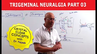 Trigeminal Neuralgia | Causes and Treatment | Part 3