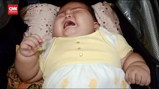 Bayi Obesitas 15 Kg di Bekasi Didiagnosis Alami Gangguan Saraf