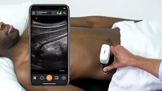 Scanning Technique: Appendix