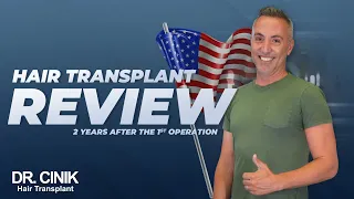 Review 3 Years After The Operation | Dr.Cinik Hair Transplant | FUE |  Hair Growth Results