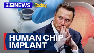 Elon Musk claims first wireless chip implanted in human brain | 9 News Australia