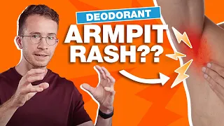 Why Your Deodorant is Giving You an Armpit Rash