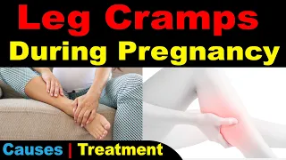 Leg Cramps During Pregnancy | Causes | Treatment |