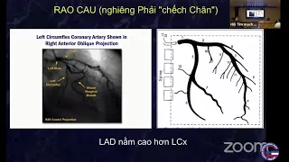 #06 Thực hành đọc phim chụp động mạch vành. ThS. Phạm Nhật Minh