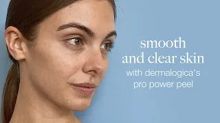 Smooth and clear skin with Dermalogica' s Pro Power Peel