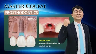 [Master Course - PROSTHODONTICS] Design of Esthetic implant Prosthesis