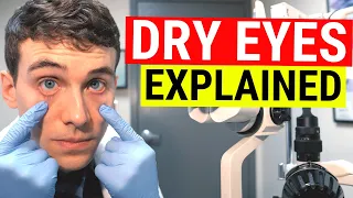 What Causes Dry Eyes? Eye Doctor Explains Dry Eye Syndrome