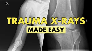 Orthopedic X Ray Interpretation Basics Explained with Examples