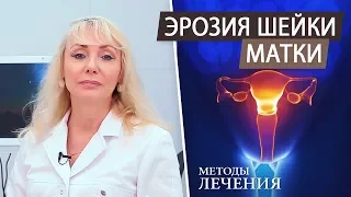 Эрозия шейки матки. Методы лечения