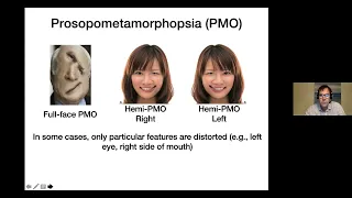Prof Brad Duchaine on "Prosopometamorphopsia: Face distortions as a window into face representation"