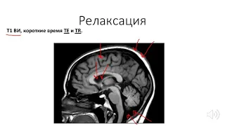 Основы МРТ(ЧАСТЬ 2).  T1 и T2 ВИ, матрица и FOV.