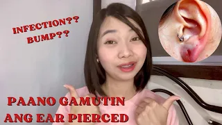 Paano gamutin ang ear pierced infection or bump | How to heal your infected ear pierced