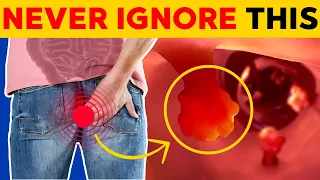 8 Critical Colon Cancer Symptoms You Should Never Ignore | BeHealthy