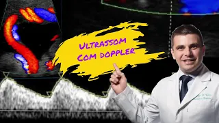 Ultrassom com Doppler