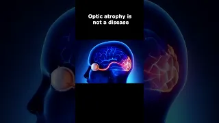 What is optic atrophy
