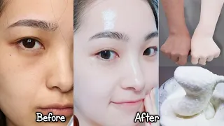 Japanese secret to whitening skin and get rid of pigmentation to get a fresh complexion