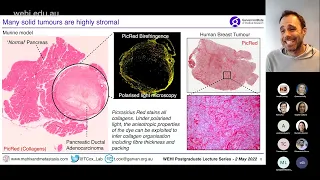 Cox T (2022): Tumour microenvironment