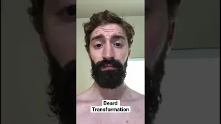 This Is my 4 month Minoxidil Beard Journey #beard #transformation #minoxidil #fyp #viral #timelapse