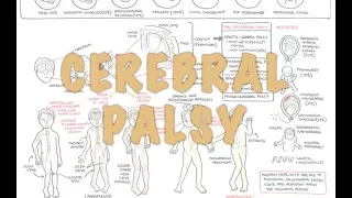 Cerebral Palsy - (DETAILED) Overview