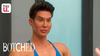 The Human Doll is Back! | Season 7 | Botched