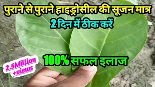 Hydrocele ka Gharelu Upay | अंडकोष में सूजन का अचूक इलाज | hydrocele ka ilaaj