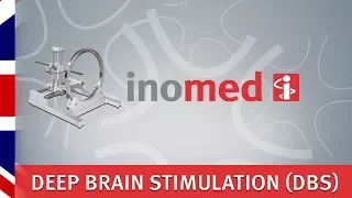 Deep Brain Stimulation - DBS - ISIS MER - stereotactic surgery - inomed